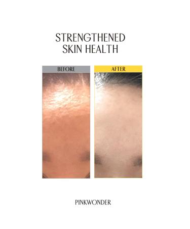 Jojoba Berrier Plus Cream 1.69oz - 24HR Moisturizer with Jojoba Oil & Hyaluronic Acid for Dry Skin | Korean Skin Care - Buy Online on GoSupps.com