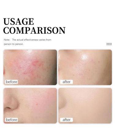 Generic Face Moisturizer for Women | Multi-Correcting Hydrating Cream for All Skin Types - 4 fl oz - Buy Online on GoSupps.com