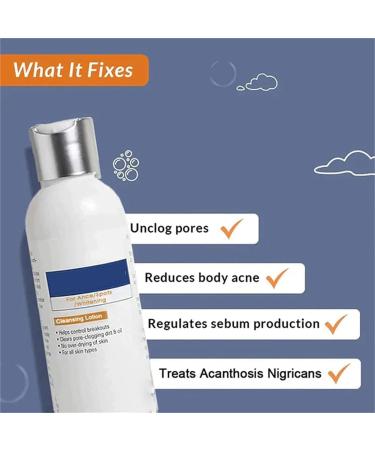 EVNI 2023 Skinenjoy Cleansing Lotion for Acne, Spots & Acanthosis Nigricans - Dark Spot Remover 50ml - Buy Online on GoSupps.com
