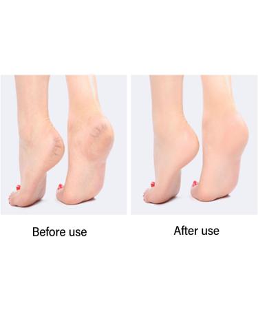 ZJchao Glass Foot File Callus Remover Dead Skin Removal for Smooth and Soft Feet Durable Foam Glass Material Gentle Exfoliation Portable Size (-1411240000912) ZJchaodvupx0fsmy-12 - Buy Online on GoSupps.com