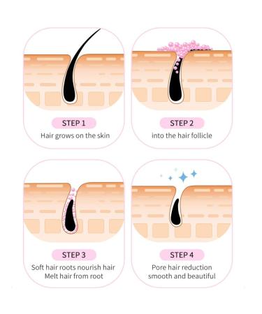 Gentle & Soothing Sensitive Depilatory Cream - Painless Hair Remover for Women | Moisturizing Face & Body Solution  - Buy Online on GoSupps.com