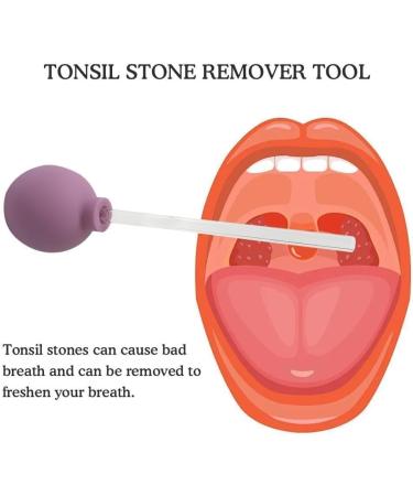 Japagzy Tonsillenstein Remover Tool | Manual Oral Cleaning Care | Tonsillenstein-Sugball for Effective Mouth Hygiene - Buy Online on GoSupps.com