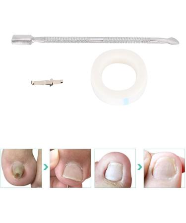Ingrowing Nail Corrector Ingrown Toenails Correction Paronychia Corrector Ingrowing Nail Corrector Ingrown Toenail Correction Paronychia Ingrown Toenail Correction Tool Foot Care Tool (set 40) - Buy Online on GoSupps.com