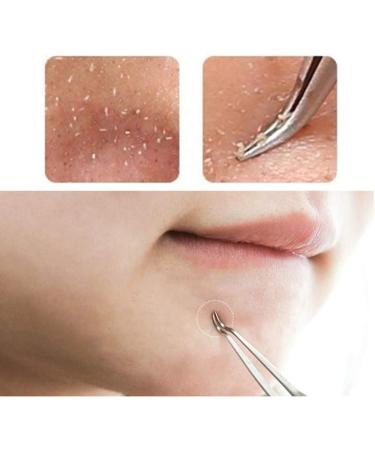 1Pc Professional Stainless Bend Curved Tweezer Blackhead Acne Clip Comedone Pimple Extractor Remover Tool for Comedone Whitehead Acne Blemish Bend ClipProfessional and Attractive - Buy Online on GoSupps.com