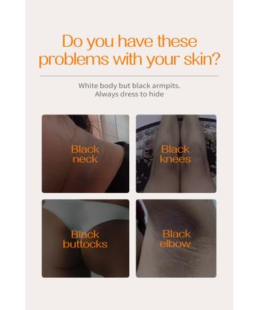 G neric 60ml Crema Para Manchas Oscuras En La Cara Crema Para Las Manchas De La Cara 1pcs Para Piel Entrepierna Manchas Codos Piernas Zonas Rodillas Cuello - Buy Online on GoSupps.com