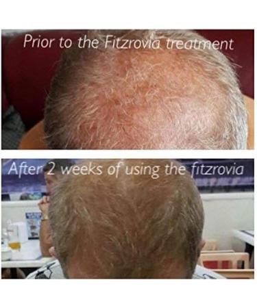 The Fitzrovia Centre Shampoo For Hair Growth - Thickening for Hair Loss & Fast Hair Regrowth Shampoo - Hair Scalp Moisturizer & Booster - Healthy Shampoo for Thinning Hair - Buy Online on GoSupps.com
