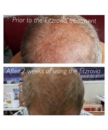 Hair Growth Conditioner - Stimulating Formula for Hair Loss Treatment | Redensyl vs Minoxidil | 250ml - Buy Online on GoSupps.com