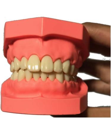 Ernzi Removable Dentures Model - Ideal Typodont for Dental Practice & Study Lessons - Buy Online on GoSupps.com