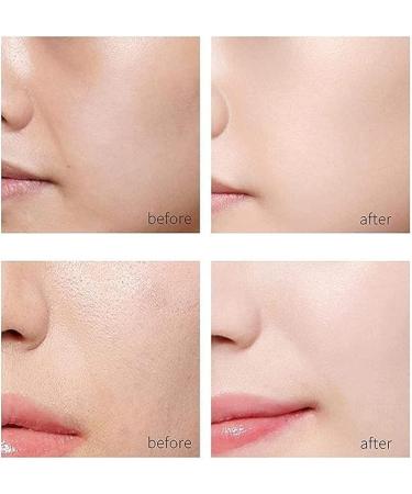 |Most Gifted| 2024 New Korean Protein Thread Lifting Set - Absorbable Collagen Thread for Face Lift - 2 Soluble Protein Thread and 5 Nano Gold Essence Combination - Buy Online on GoSupps.com
