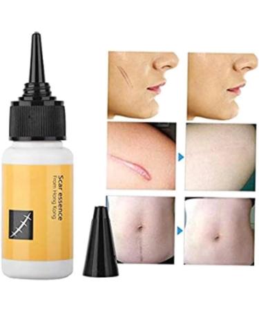 Scar Removal Cream - Acne Scar Treatment Serum for Smooth & Delicate Skin 20mL - Buy Online on GoSupps.com