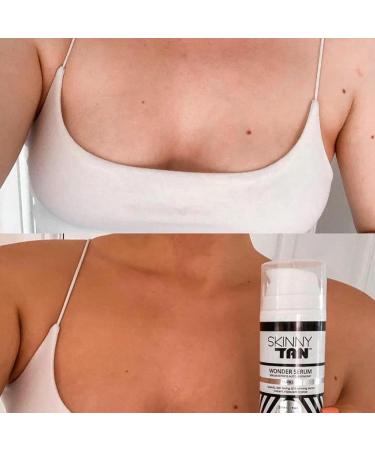 Skinny Tan Wonder Serum Anti-Ageing Express Tanning Serum 145ml |Tanning Serum with Youth Boosting Q10 and Vitamin E | Instant Tan | Cruelty Free & Vegan Skincare for Radiant Natural Glow - Buy Online on GoSupps.com