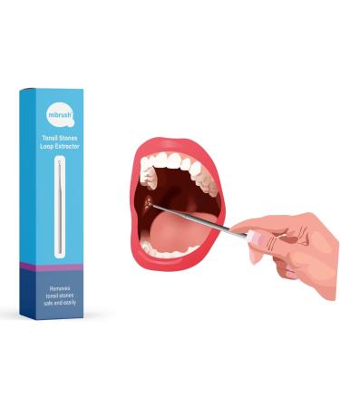 MiBrush Tonsil Stones Loop Extractor | Tonsil Stone Removal - Stainless Steel - Fresh Breath - Healthy Tonsils