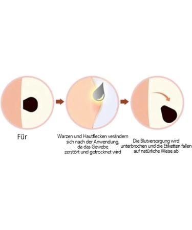 Bee Venom Ointment & Cream - 30ml Moisturizing Treatment for All Skin Types - Shop Now! - Buy Online on GoSupps.com