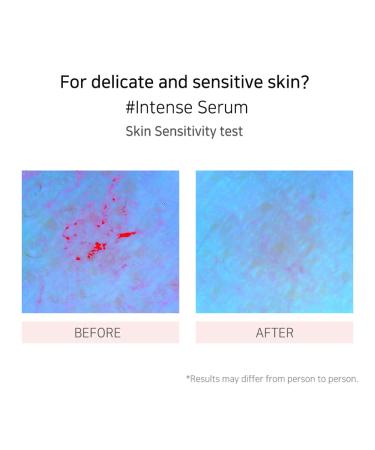 Vegan Green Mild Intense Serum | SOS Repair Skin Barrier Solution - 3.71 Fl Oz - Shop Now - Buy Online on GoSupps.com