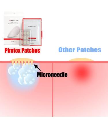 PIMTOX Patch - Microneedle Acne Pimple Patches for Skin Troubles | SKINBUILDERS 27 Patches - Buy Online on GoSupps.com