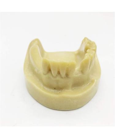 Fhuili Teeth Implant Model - Realistic Dental Simulation for Practice & Education | Lower Half Teeth Demonstration Model - Buy Online on GoSupps.com