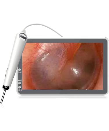 Ear Wax Removal with 7 TFT LCD Screen Otoscope Camera with Light 3.6mm HD Digital Ear Otoscope with 6 LED Lights Ear Camera Ear Cleaner with Camera and Light for Kids/Adults IP67 Waterproof