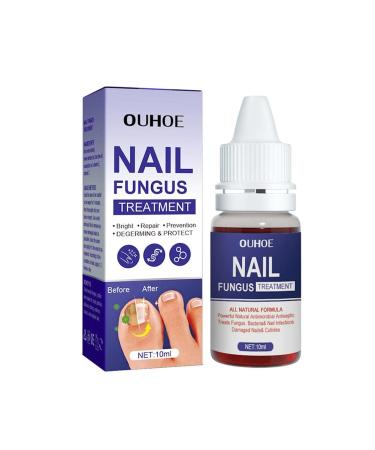 ZERZK 10ml Repair Nail Fungus Treatments Essence Foot Care Nails AntiInfection Toe Fungus Serum Onychomycosis Removal Gel