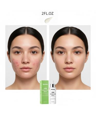 10% Azelaic acid Serum for face Inspired By Korean Skincare K Beauty Azalecic Acid Acido Azelaico Redness Soothing Serum with Azaleic acid Hyaluronic Acid Niacinamide Spot Care(2FL.OZ/60 ML) - Buy Online on GoSupps.com