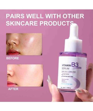 2PCS Vitamin B3 Serum Anti Wrinkle Facial Serum Fade Dark Spot Chloasma Lighten Melanin Pigmentation Smooth Pores Rejuvenation Brightening Moisturizing Essence - Buy Online on GoSupps.com