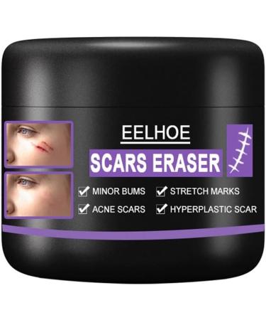 Scar Repair Cream | Acne Scar Removal | Pigmentation Corrector - 10/30/50g - Buy Online on GoSupps.com