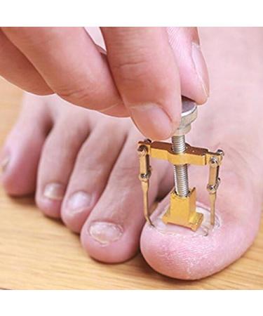 Risingmed Ingrown Toe Nail Correction Tool Pedicure Tool Care Nail Orthosis Armor Corrector Roll a Cover Correction Device Paronychia Special Pedicure Tools - Buy Online on GoSupps.com