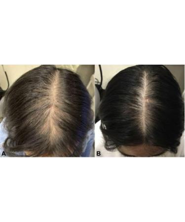 Organic Rosemary Mint Hair Pomade - Strengthening Grease for All Hair Types | Scalp & Hair Treatment (4 OZ) - International Shipping Available - Buy Online on GoSupps.com