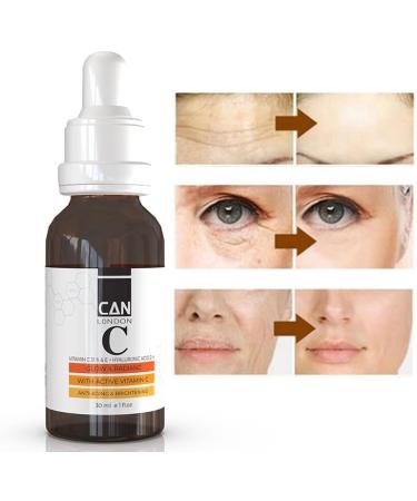 ican london Vitamin C Serum for Face Anti Aging Serum with Hyaluronic Acid Anti-Aging & Brightening Serum for Dark Spots Wrinkles Glow & Radiance 30 ml - Buy Online on GoSupps.com