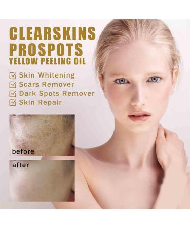 2024 New Exfoliating Cleansing Oil | Centella Deep Cleansing Moisturizer for All Skin Types - Buy Online on GoSupps.com
