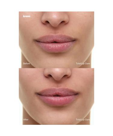 Peptide and Ceramide Metal Tip Lip Balm Strawberry and Repairing Revitalizing Peeling Effect Lip Mask Vegan Moisturizing (1x13 ml +1x8 ml) Moisturizing - Buy Online on GoSupps.com