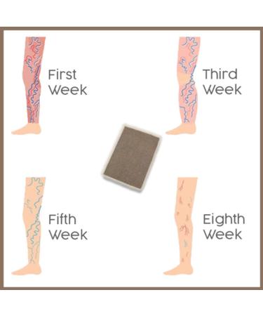 18Pcs Pat Varicose Veins Treatment Plasters - Herbal Medicine for Spider Veins & Vasculitis - Effective Chinese Remedies - Buy Online on GoSupps.com