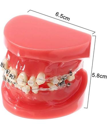 Buy Model Doll-10 Orthodontic Braces for Adults | Ceramic Demonstration Teeth | Mobile Medical Science & Teaching Research - Buy Online on GoSupps.com