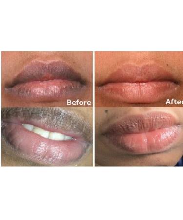 Lip Care Set: Pink Lightening Cream & Dark Smoke Lip Oil Treatment - Buy Online on GoSupps.com