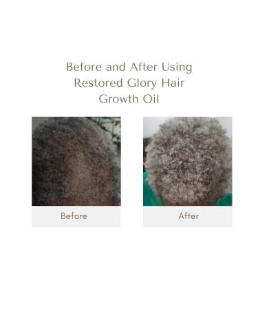 Restored Glory Hair Growth Oil - 2 fl oz | Promotes Healthy, Thicker, Longer Hair - Buy Online on GoSupps.com
