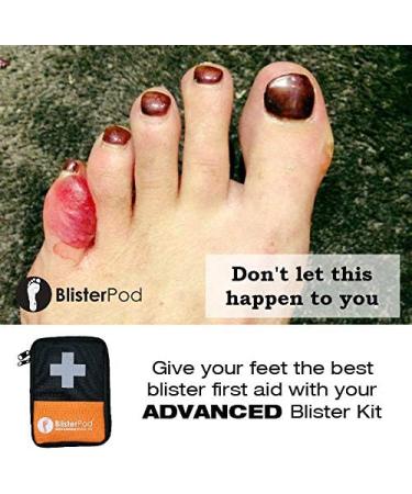 BlisterPod Advanced Blister Kit (18 Pc. Set) for Sport & Outdoors | Foot Blister Prevention & Treatment | Travel/Hiking/Running/Sports - Buy Online on GoSupps.com