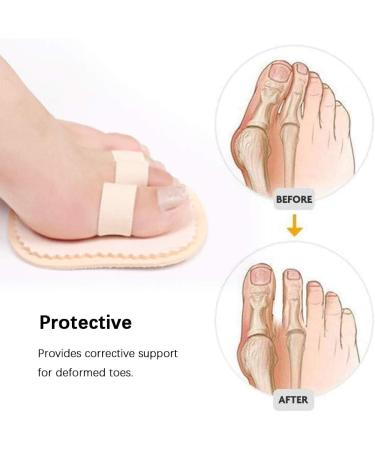 Agatige Toe Straighteners Set - 3 PCS Toe Spacers & Separators for Bunion Corrector & Hammer Toe Support - Buy Online on GoSupps.com