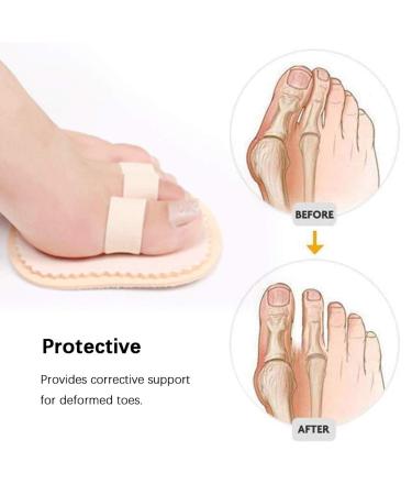 Bunion Corrector & Toe Straightener - Adjustable Splint & Spacer for Hammer Claw & Crooked Toes - Foot Care Solution - Buy Online on GoSupps.com