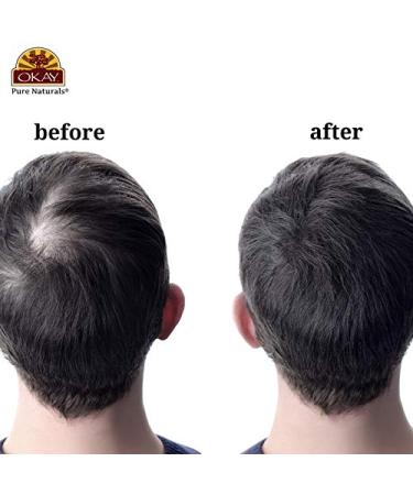 Men's 3-in-1 Castor Oil Shampoo, Conditioner & Treatment | Prevents Dandruff, Stimulates Hair Growth | For All Hair Types | Sulfate, Silicone & Paraben Free | 16 oz - Buy Online on GoSupps.com