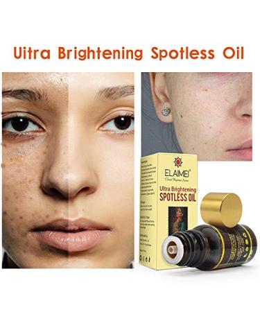 ALIVER Ultra Brightening Spotless Oil - Dark Spots, Age Spots, Hyperpigmentation, Stretch Marks - Skin Whitening Treatment - 2 Pack - Buy Online on GoSupps.com