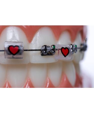 Snapcaps Paw Print 10 Ct: Bracket Cover Bumper for Braces - Orthodontic Accessories - Buy Online on GoSupps.com