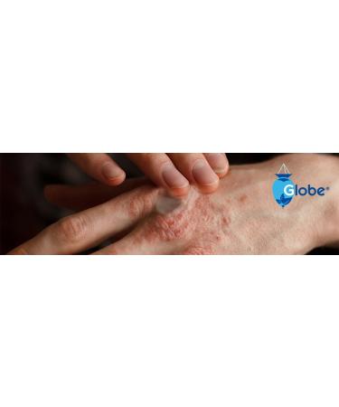 Globe Hydrocortisone 1% Maximum Strength Transparent Ointment 1 oz (12 Pack) | Anti-Itch Relief for Various Skin Conditions - Buy Online on GoSupps.com
