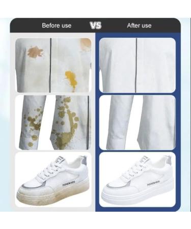 Clothing Stain Removal Wet Wipes Individual Wrapped Cleaning Wipes Instant Stain Wipes Mini Stain Remover Wipes Emergency Stain Rescue Stain Remover (1Pack) - Buy Online on GoSupps.com