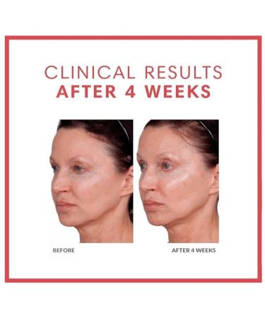 Consult Beaute Volumagen - Collagen Facial Serum Concentrate for Nourishing & Plumping Skin - Hydrates and Temporarily Fills for Smoother Bouncy Skin - Hyaluronic Acid & Vitamin C - 2 Fl. Oz. 2 Fl Oz (Pack of 1) - Buy Online on GoSupps.com