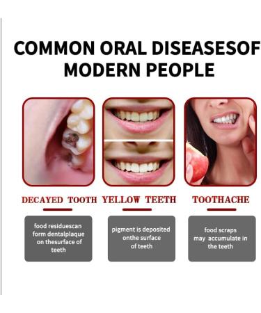 SP7 Probiotic Toothpaste Whitening | Ultra Whitening & Deep Cleaning for Fresh Breath | International Shipping Available - Buy Online on GoSupps.com