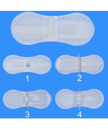 Baby Feeding Tube Pad G Tube Covers - Pack of 5 Kids Oval Cover- Stabilization Device for Peg, J, PD Tubing - Catheter Adhesive Dressing Patch Fixation Accessories - Buy Online on GoSupps.com