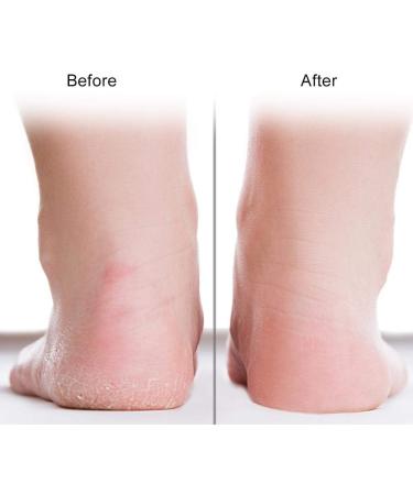 Silicone Gel Moisturizing Socks for Foot Care | Anti-Riss Protection for Plantar Fasciitis & Heel Spurs - Lindle M-Skin - Buy Online on GoSupps.com