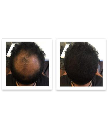 FEBRON Spray Applicator Pump - Easy and Precise Hair Extension Application - Buy Online on GoSupps.com