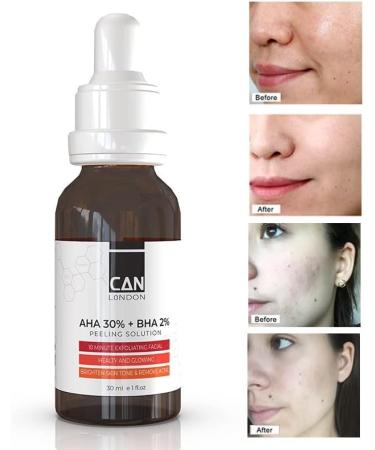 ican London AHA 30% + BHA 2% Serum - Healthy Exfoliating Brightening Facial Serum 30ml - Buy Online on GoSupps.com