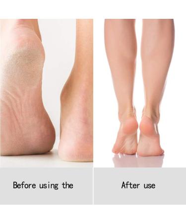 RIYAN Balnafen Hand Wax Hand Mask Foot Mask and Feet Mask Exfoliating Moisturizing Hand and Foot Care Set 1 - Buy Online on GoSupps.com