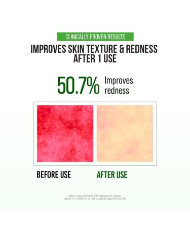 JUMISO D-Panthenol Barrier Soothing Serum (70ml/2.37oz) Korean 10 Types Hyaluronic Acid Cooling Face Serum for Oily Acne Prone & Sensitive Skin Centella Niacinamide Gentle BHA Fragrance-Free - Buy Online on GoSupps.com